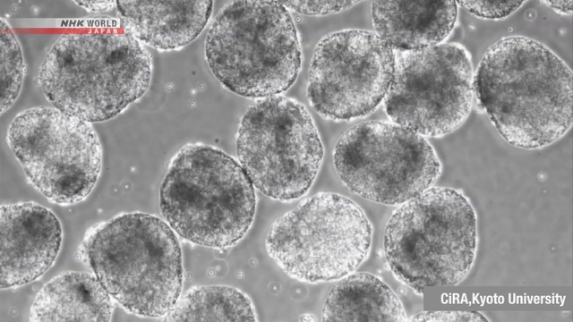 Terobosan Medis: Jepang Setujui Penggunaan Praktis Produk Sel iPS Pertama di Dunia