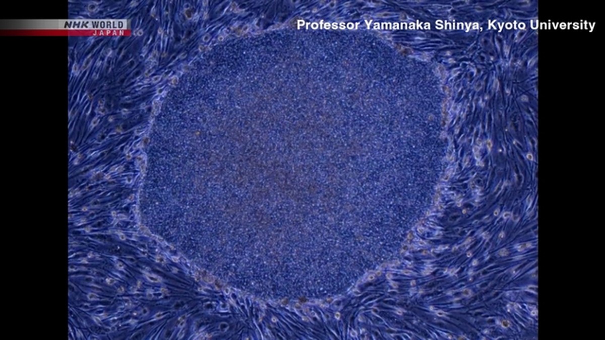 Panel Kemenkes Jepang Bahas Persetujuan Dua Terapi Sel iPS untuk Jantung dan Parkinson