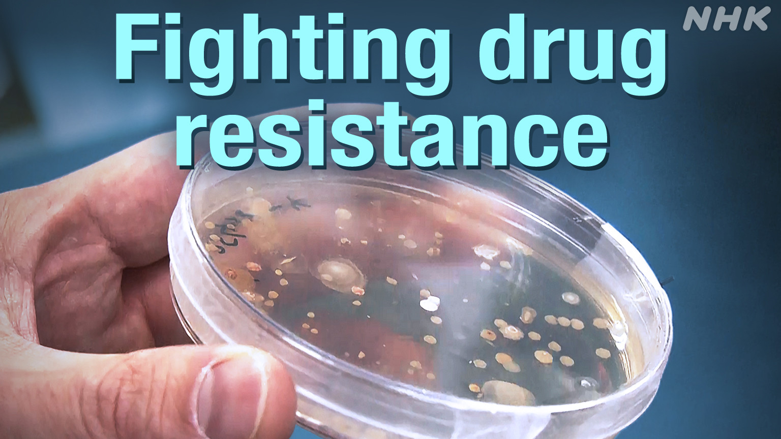 Ilmuwan Berpacu Melawan Resistansi Obat: Ancaman Global Menuju 2050