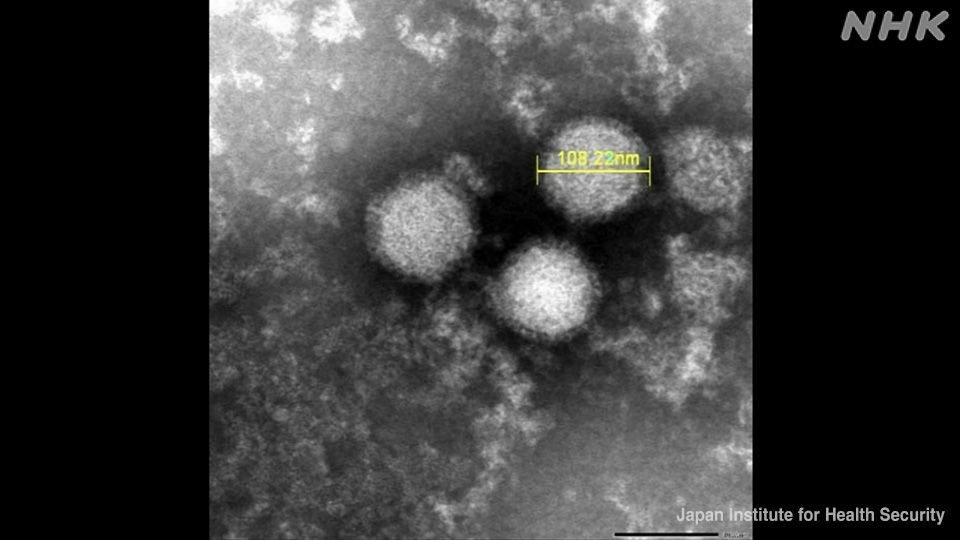 Virus SFTS