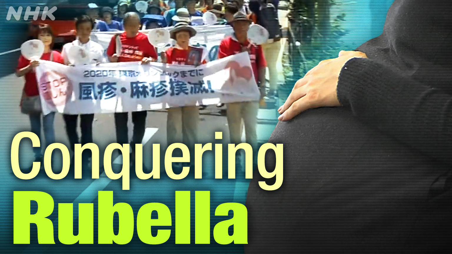 Jepang Sukses Menghapus Penularan Endemik Rubella