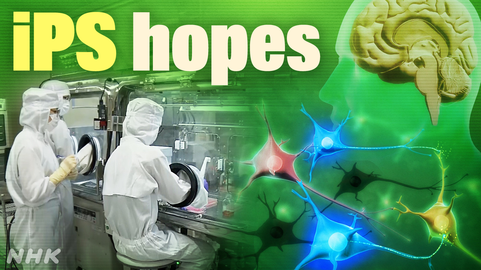 Langkah Besar Jepang Menuju Pemanfaatan Praktis Pertama di Dunia untuk Sel iPS