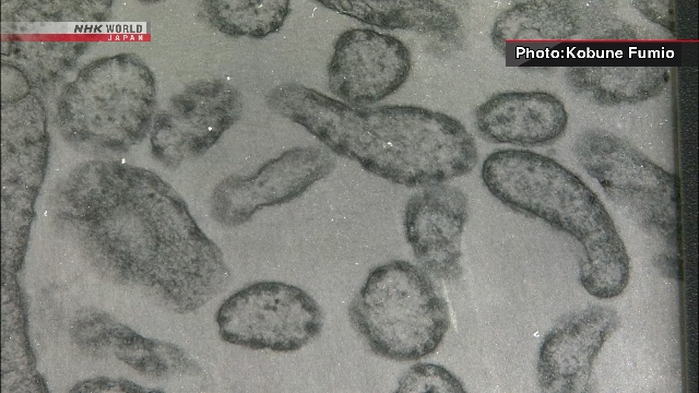 Kasus Campak di Jepang Meningkat Pesat