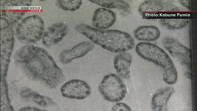 Kasus Campak Melonjak di Jepang