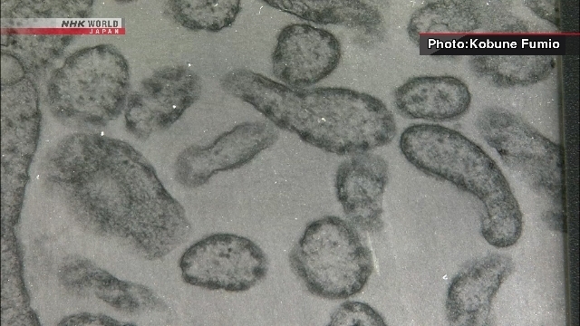 Kasus Campak di Jepang Lampaui Total Tahun Lalu